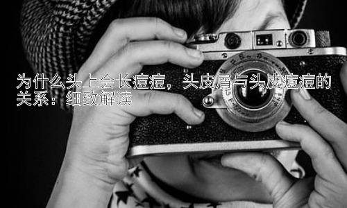 为什么头上会长痘痘，头皮屑与头皮痘痘的关系：细致解读插图